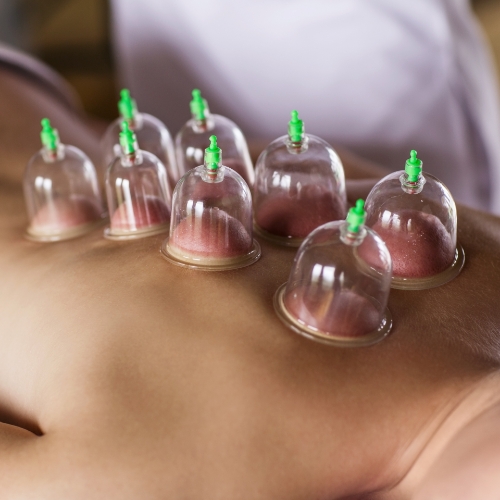 cupping-Suncare-therapy-inc-miami-lakes-miami-fl