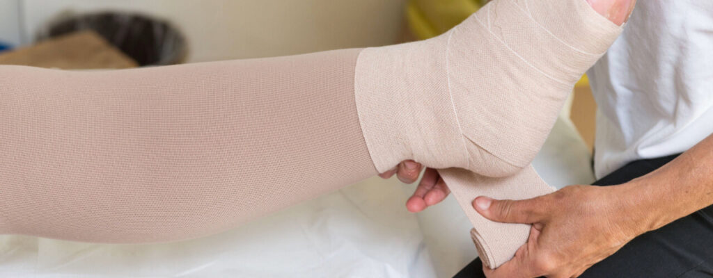 Caring for Aging Limbs: Lymphatic Therapy’s Impact on Edema Management