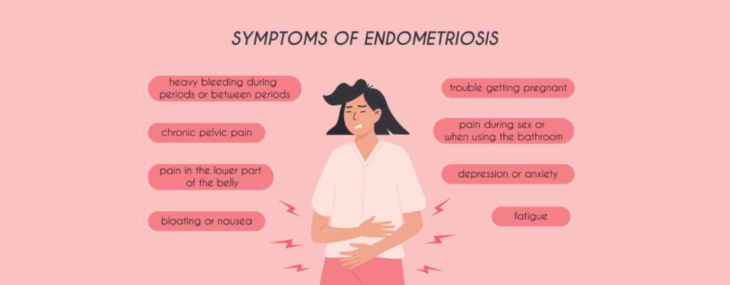Endometriosis and Pelvic Pain: What You Need to Know