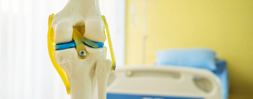 Maximizing Recovery After Joint Replacement Surgery